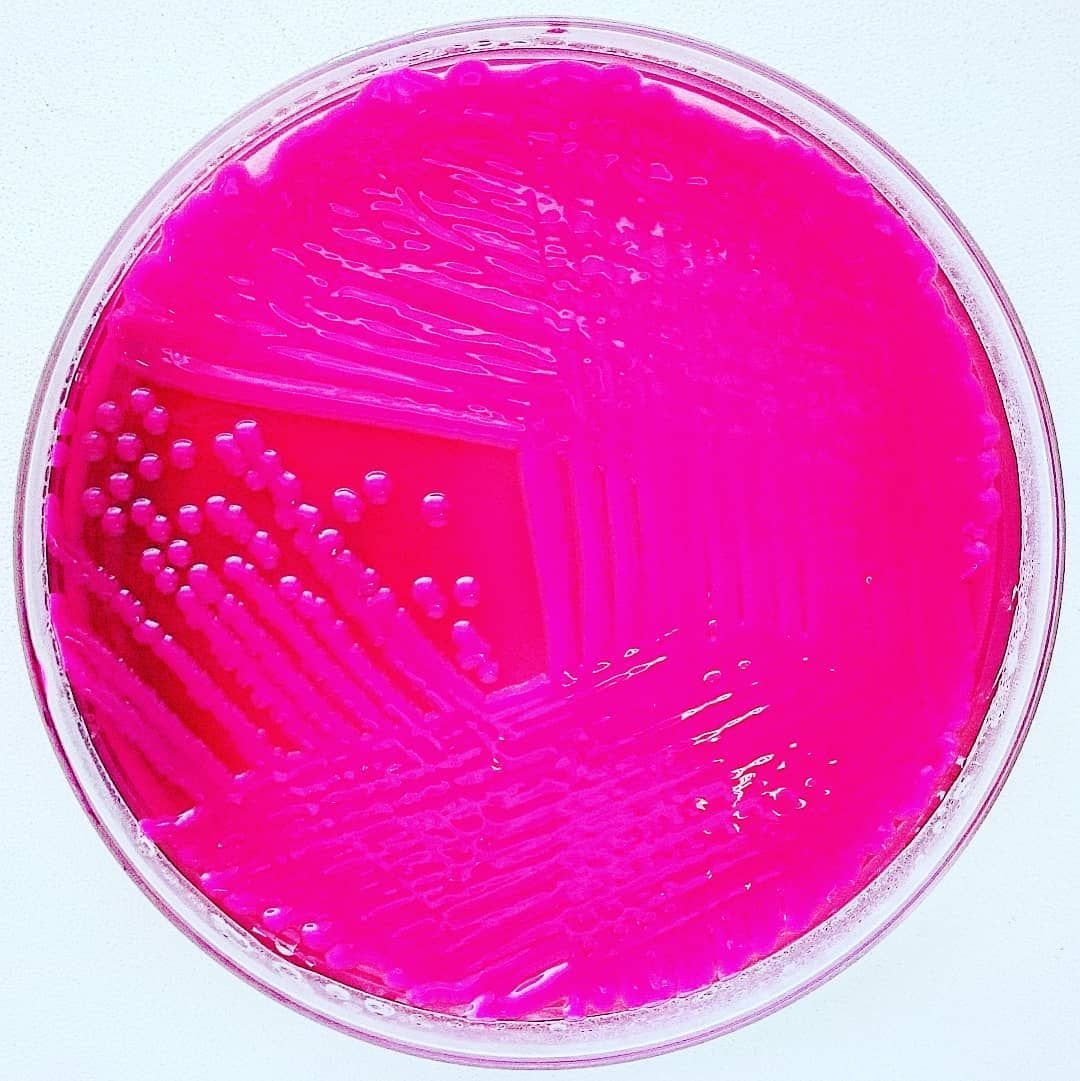 Escherichia coli лактозонегативная