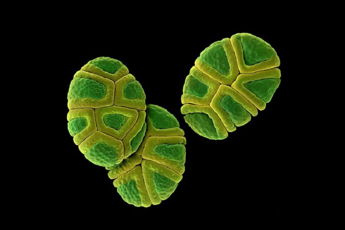 Гены пыльцы. Пыльца акации под микроскопом. Пыльцевое зерно микроскоп. Пыльца сосны микрофотография. Пыльца розы под микроскопом.