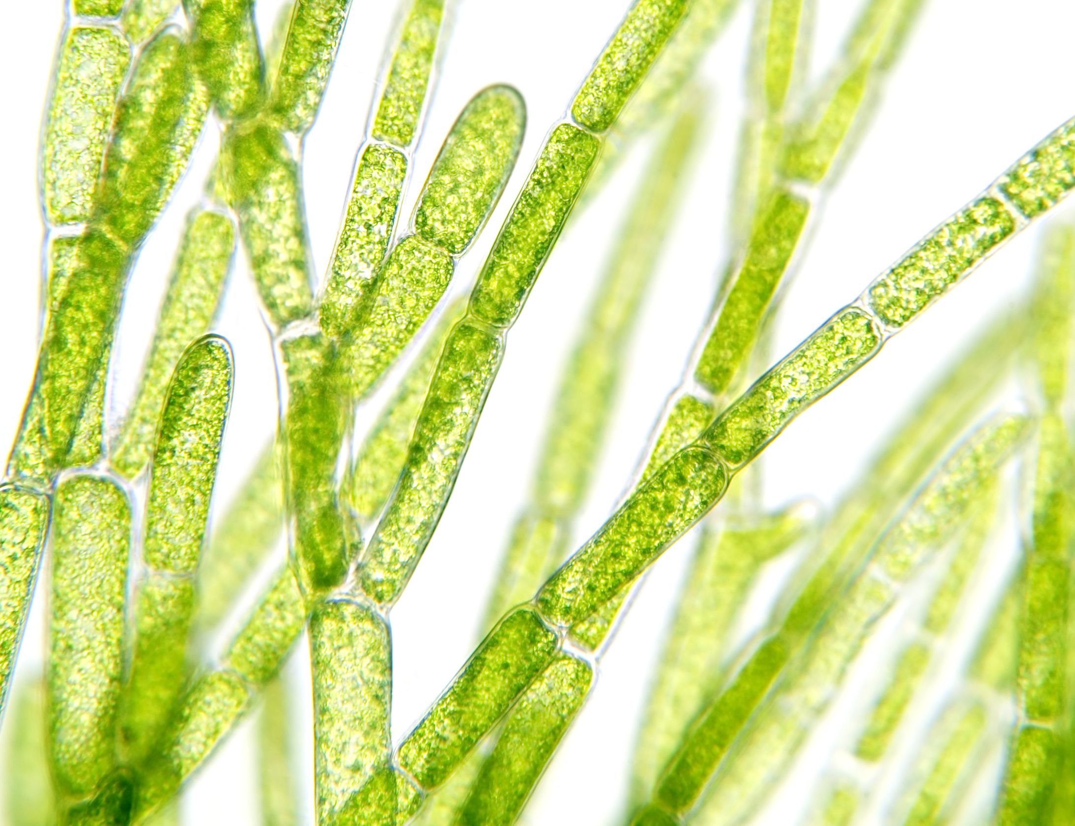Низшие растения спирогира. Кладофора водоросль. Кладофора водоросль микроскоп. Кладофора водоросль под микроскопом. Кладофора нитчатая.
