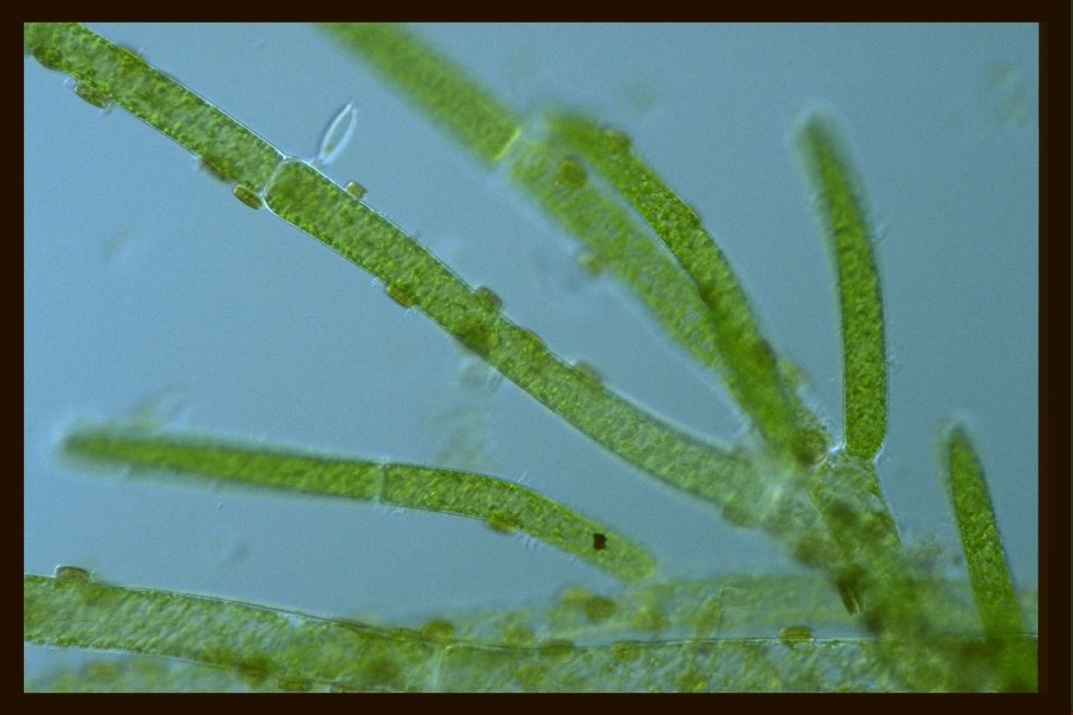 Кладофора хвощ полевой редька дикая среда обитания. Кладофора водоросль. Кладофора микроскоп. Кладофора водоросль микроскоп. Кладофора таллом.