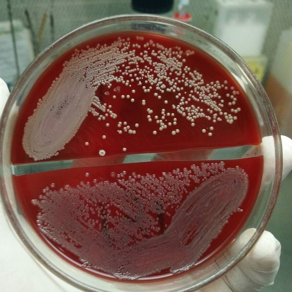 Стафилококк раствор. Trichophyton rubrum чашка Петри. Золотистый стафилококк на чашке Петри. Золотистый стафилококк гемолиз.