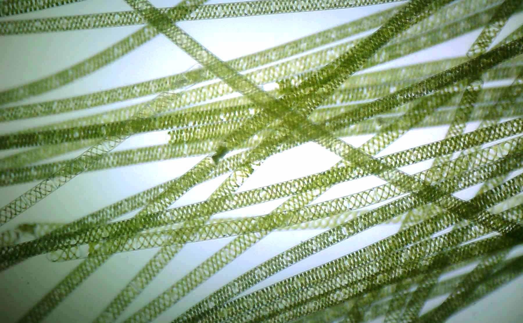 Спирогира нитчатая. Нитчатая водоросль спирогира. Многоклеточная нитчатая зелёная водоросль спирогира. Водоросль спирогира под микроскопом. Многоклеточные зеленые водоросли спирогира.