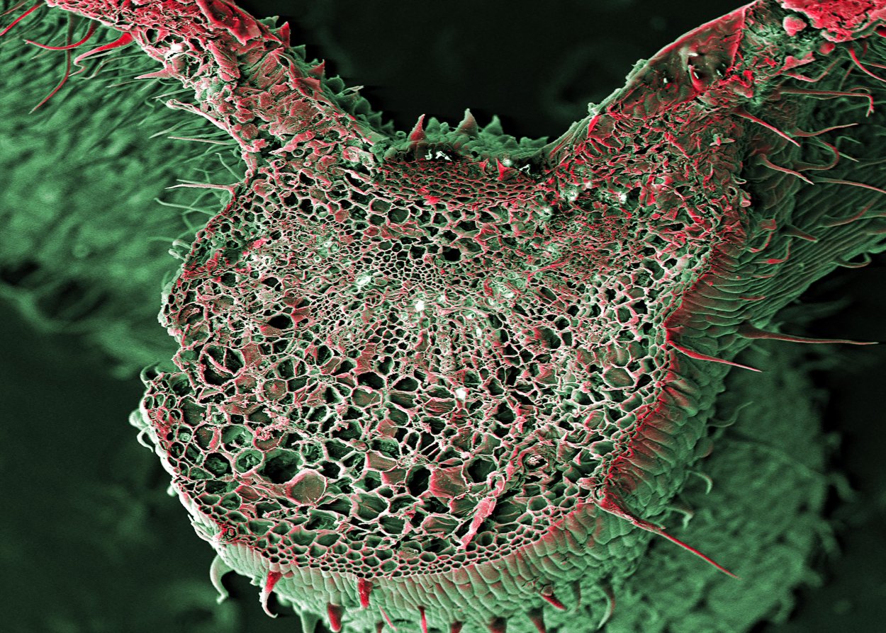 Клетка ТГК под микроскопом