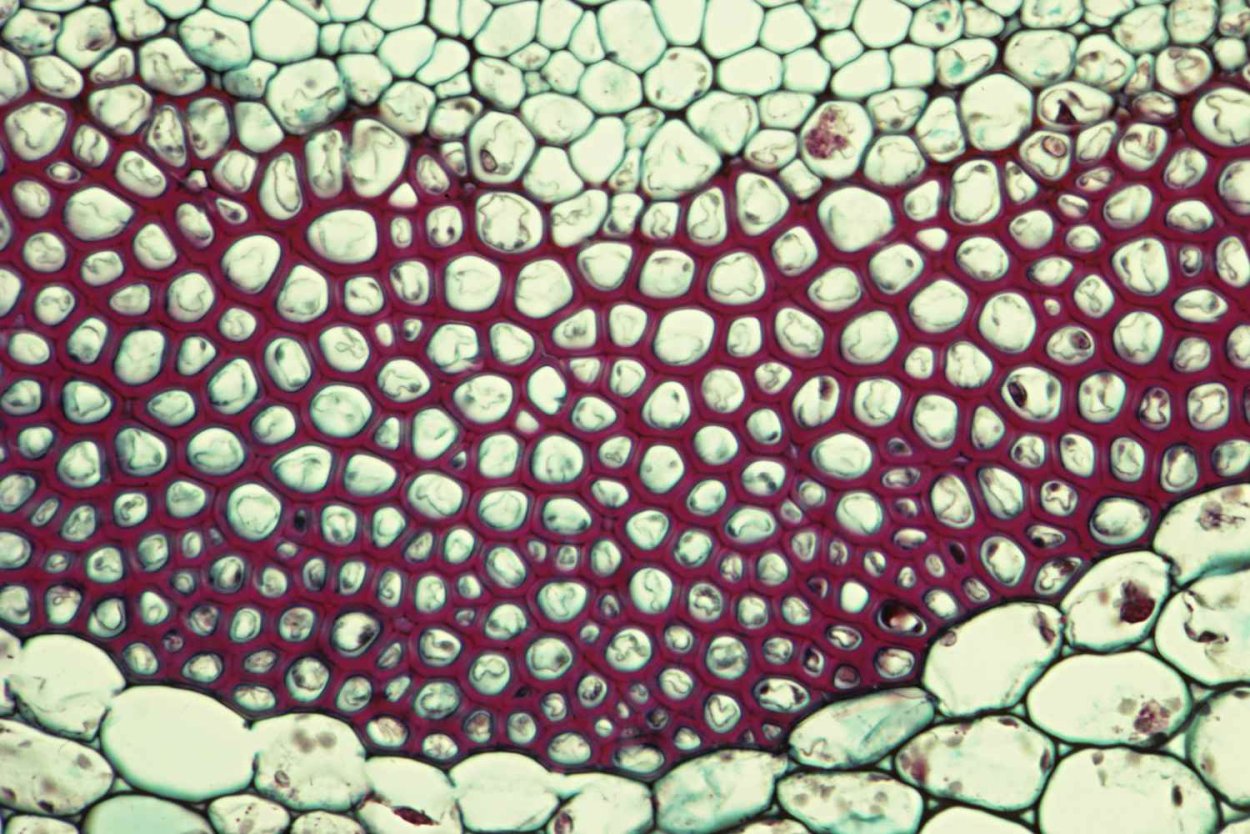Склеренхима растений под микроскопом