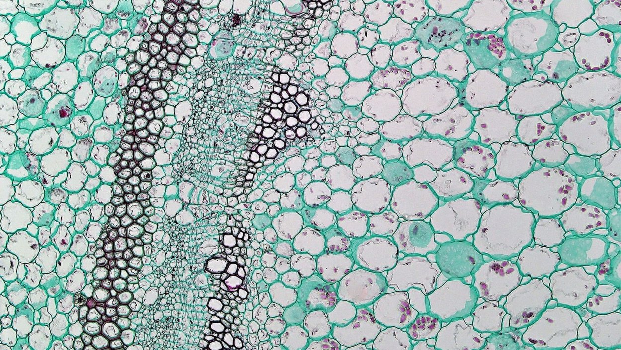 Микроскопия склеренхима