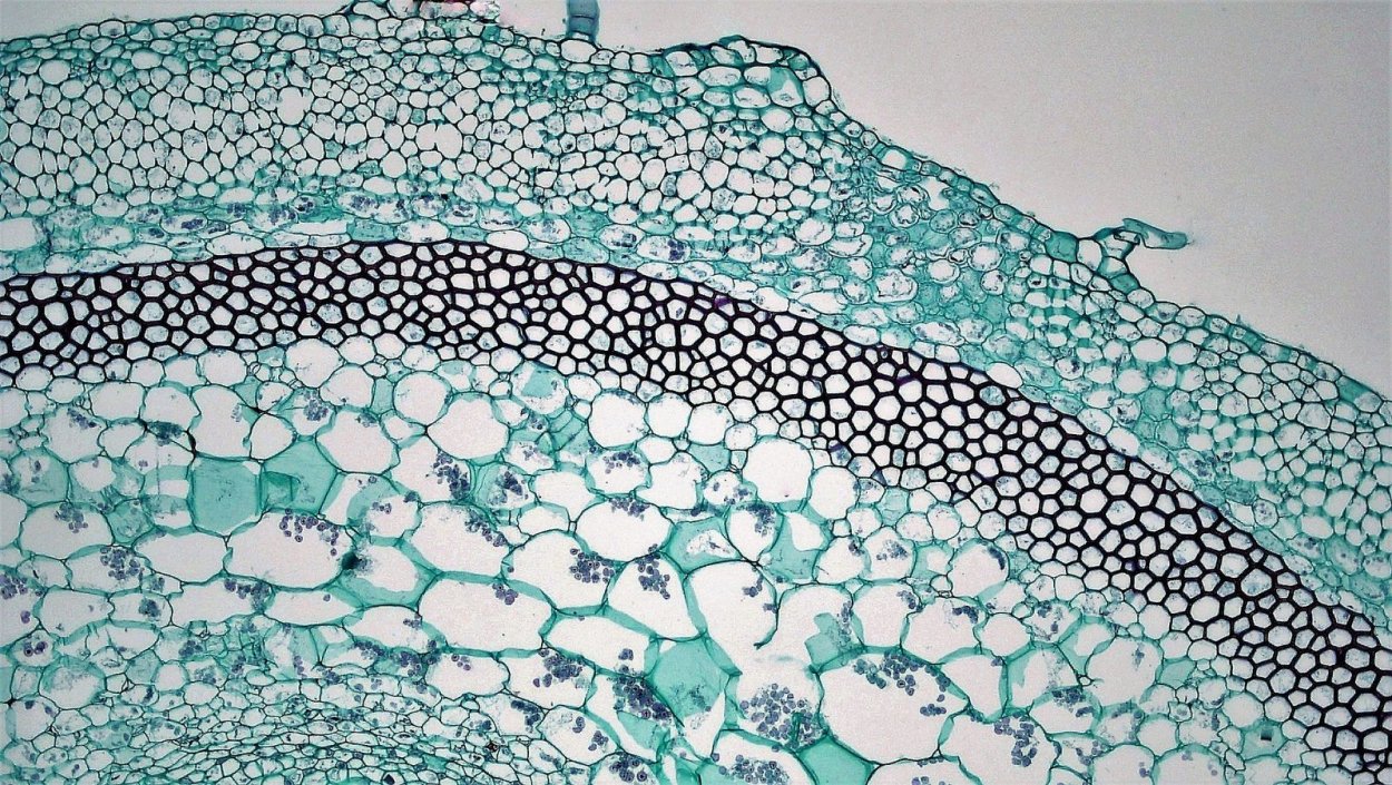 Запасающая паренхима микроскопом