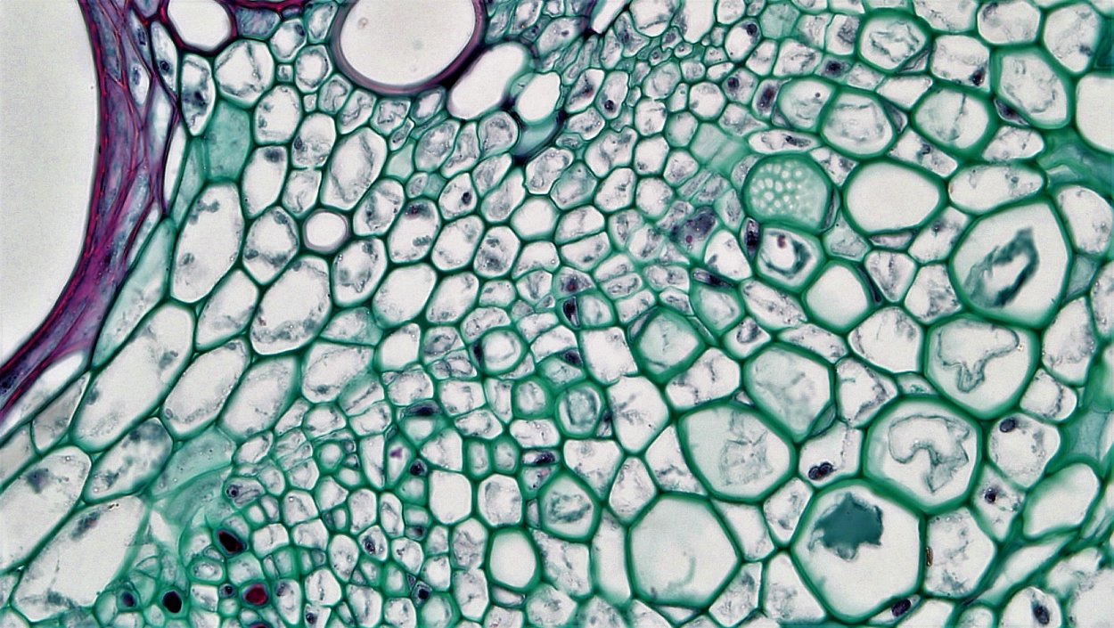 Склеренхима растений под микроскопом