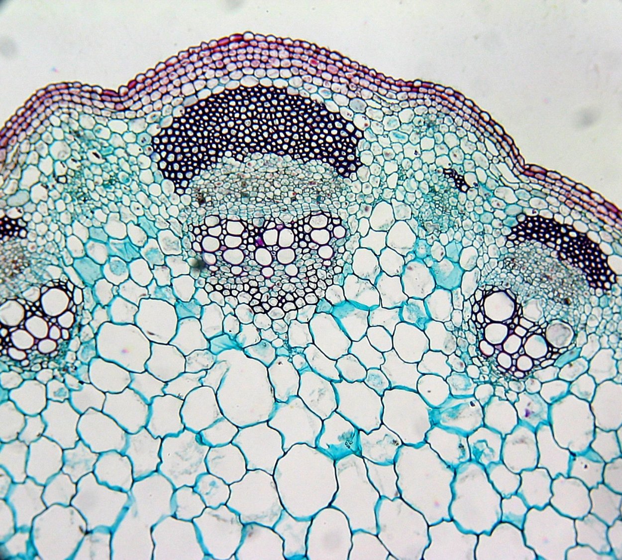 Vascular Bundle