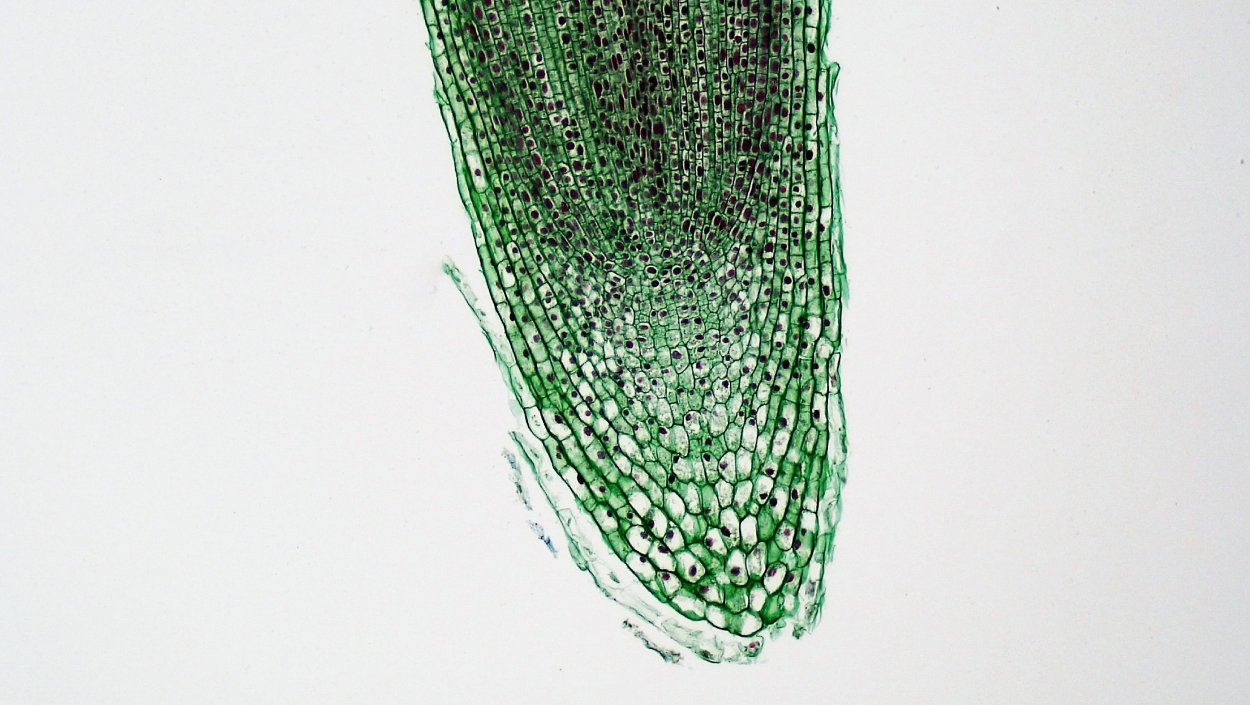 Plant Tissues