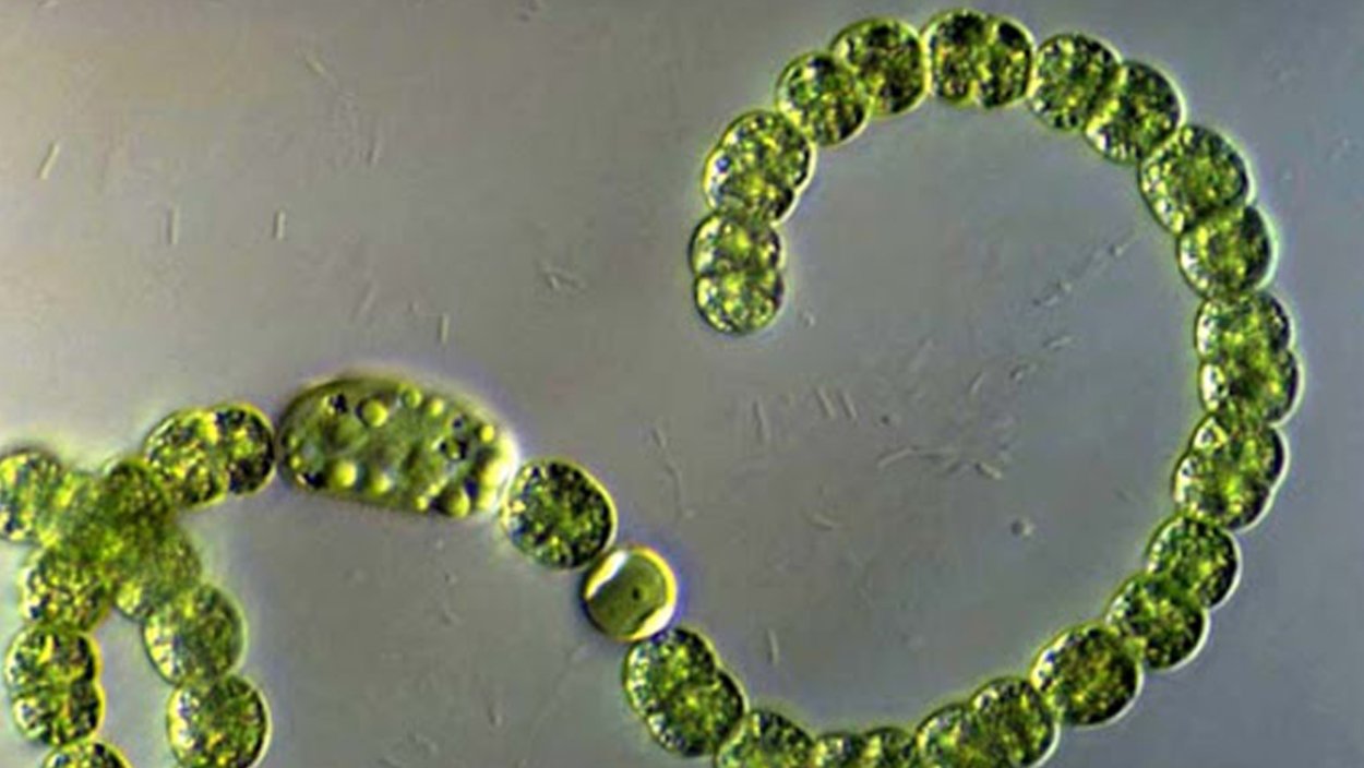 Цианобактерия Anabaena