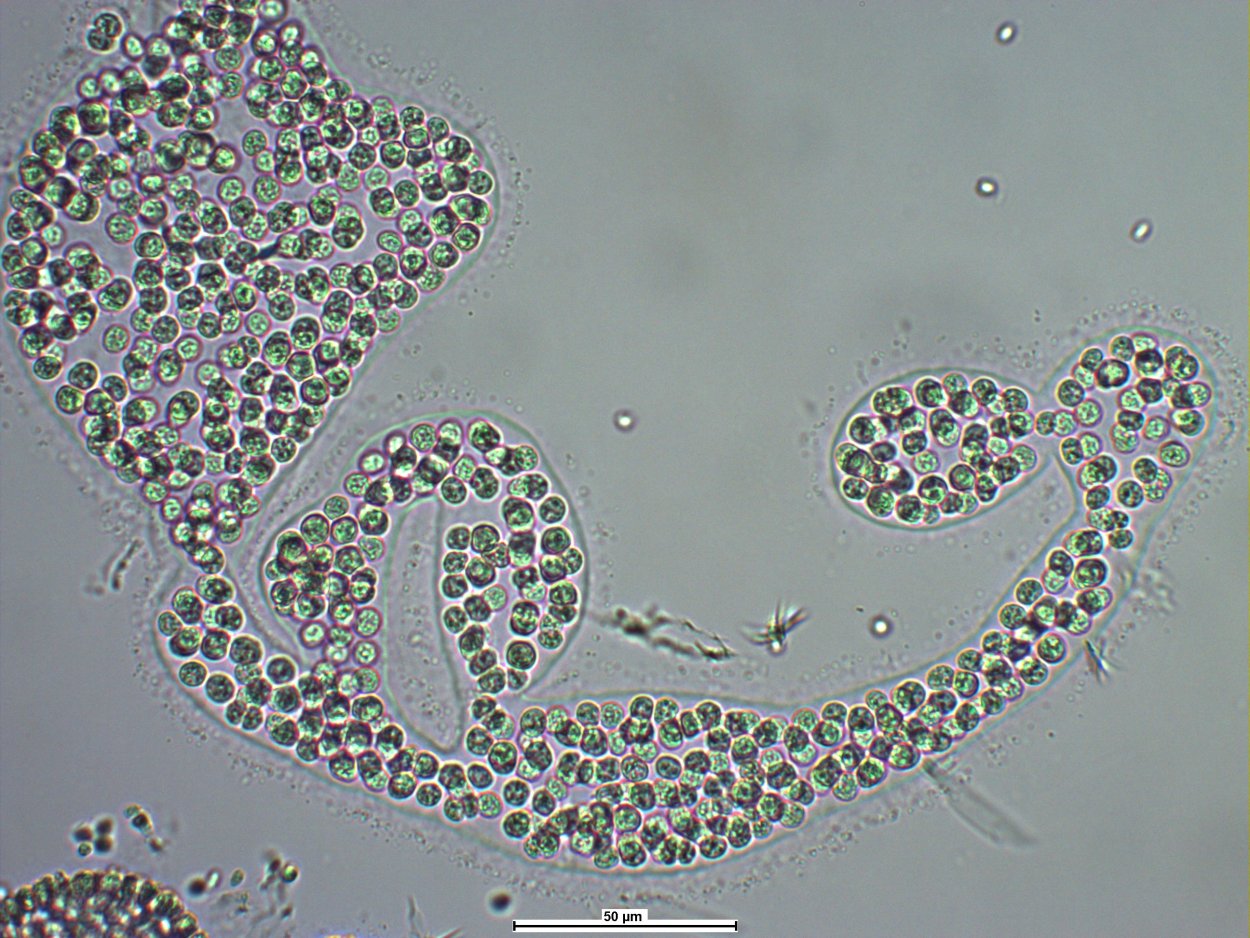 Микроцистис водоросль