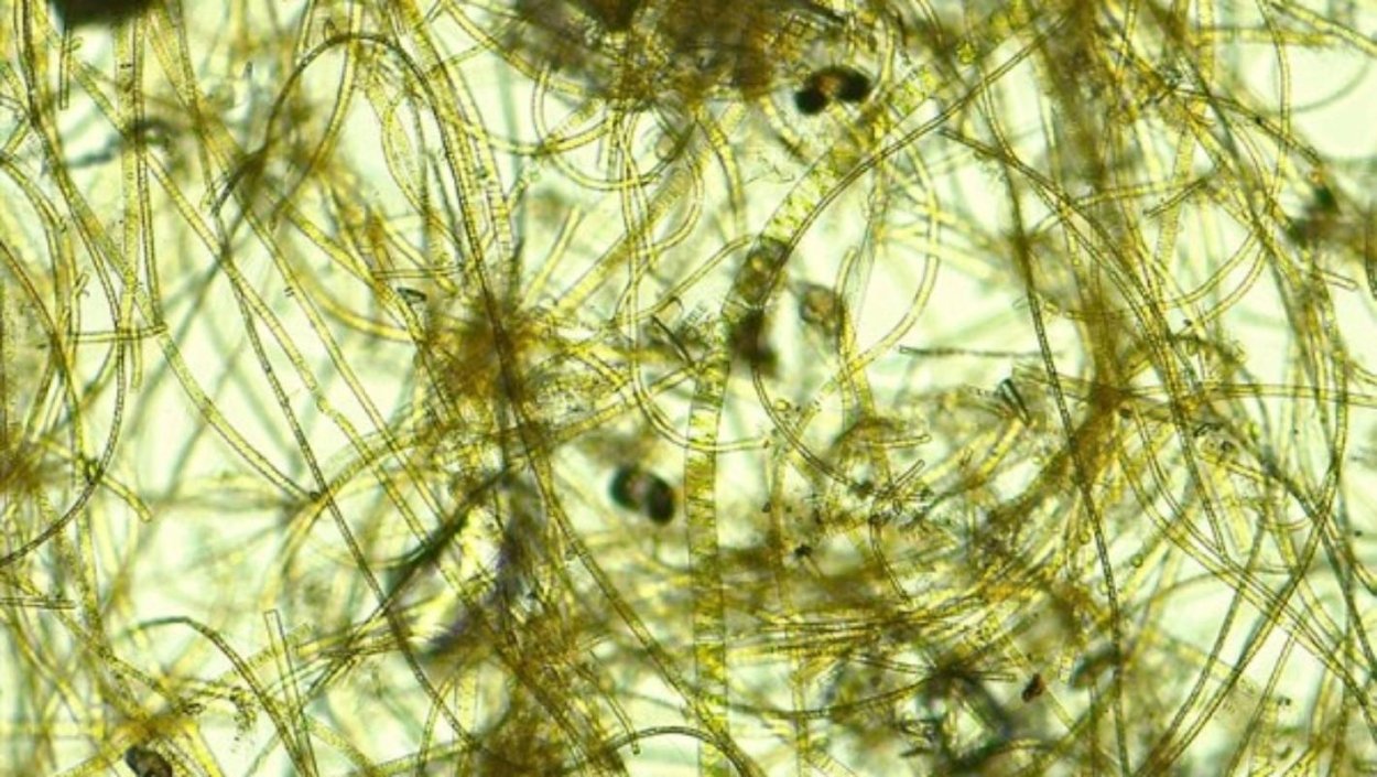 Сине-зеленые водоросли (Cyanophyta)