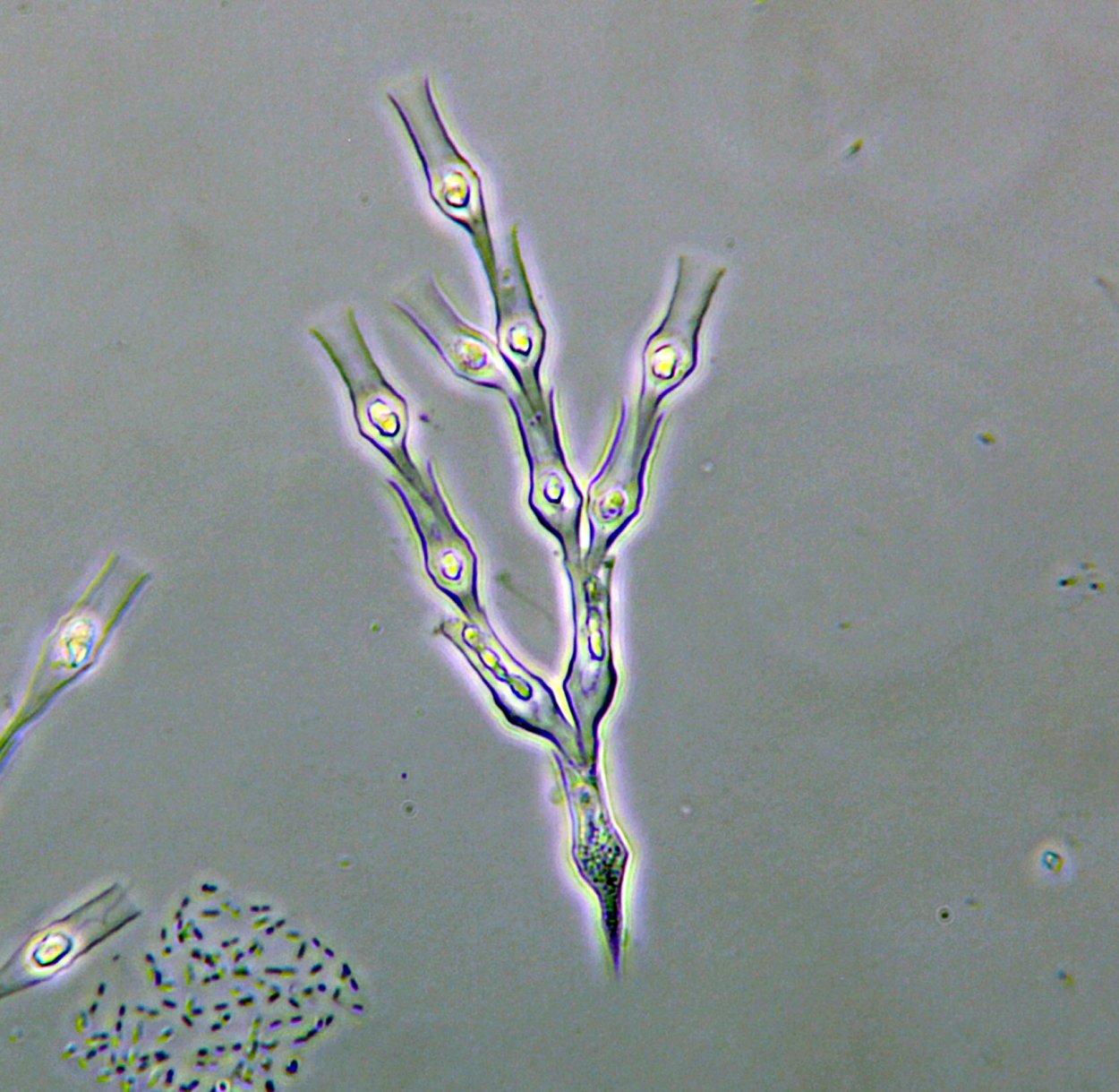 Dinobryon Sertularia