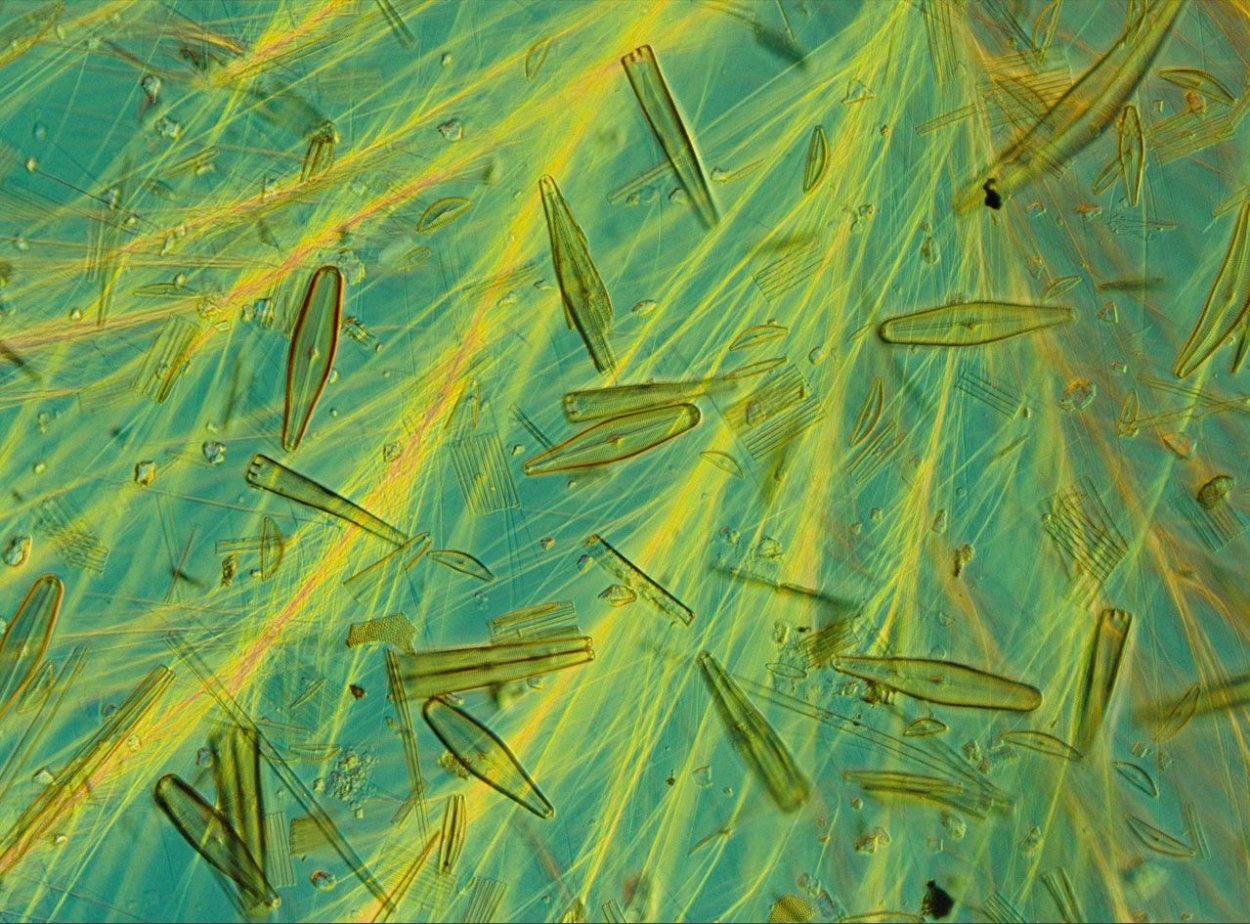 Фитопланктон в океане. Фитопланктон водоросли. Фитопланктон диатомовые водоросли. Диатомовые водоросли под микроскопом. Скелеты диатомовых водорослей.