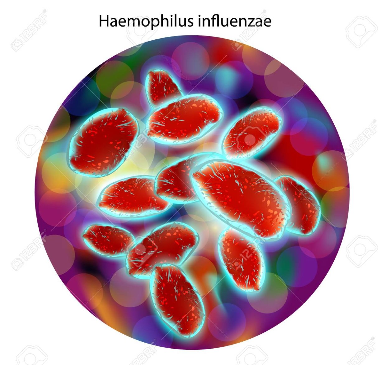 Haemophilus influenzae b. Бактерии Haemophilus influenzae. Гемофильная инфекция возбудитель. Бактерия гемофильная палочка. Гемофилус инфлюэнце.