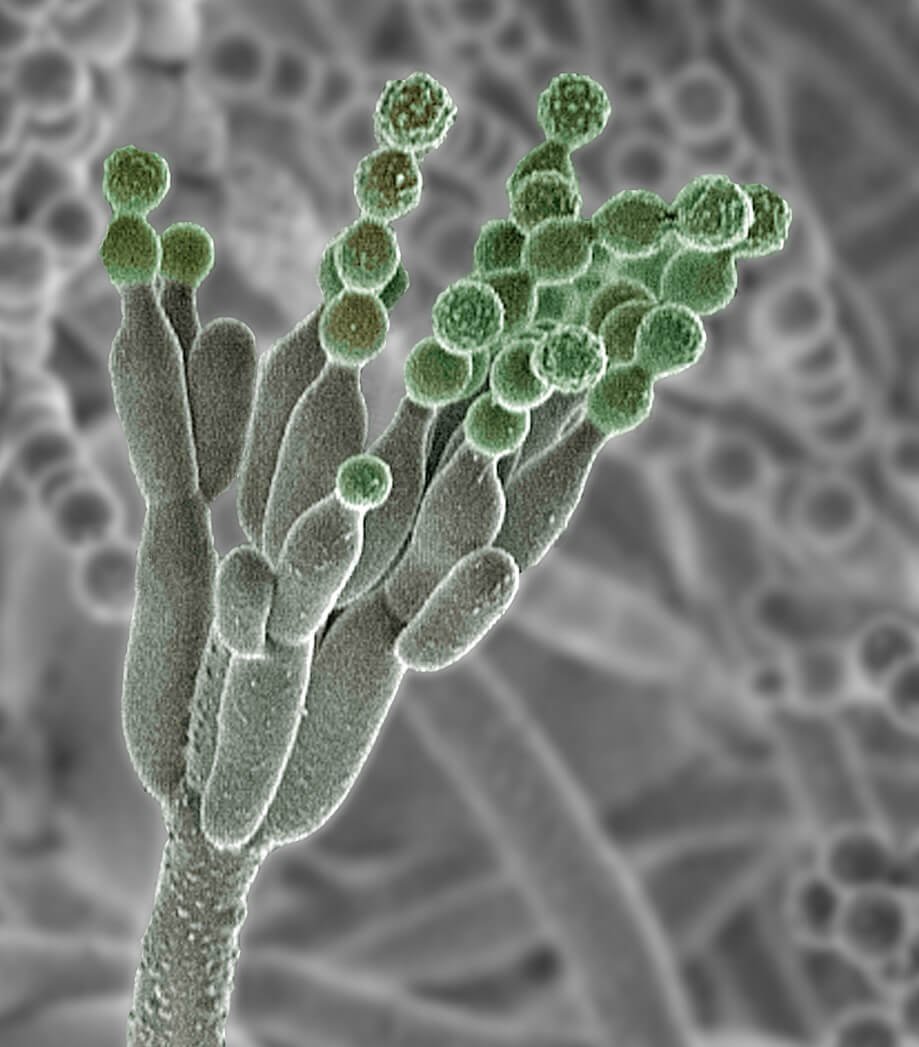 Микроскопические одноклеточные грибы