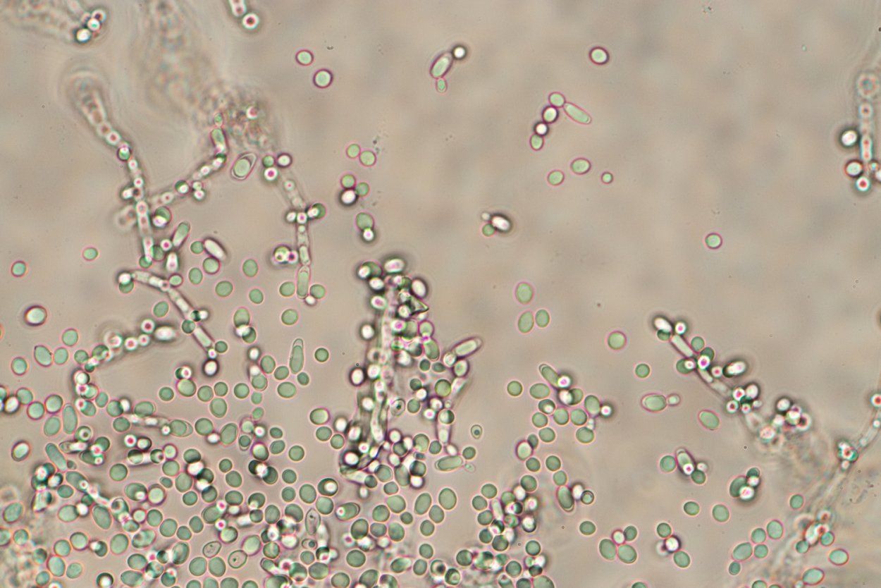 Дрожжи Saccharomyces cerevisiae под микроскопом
