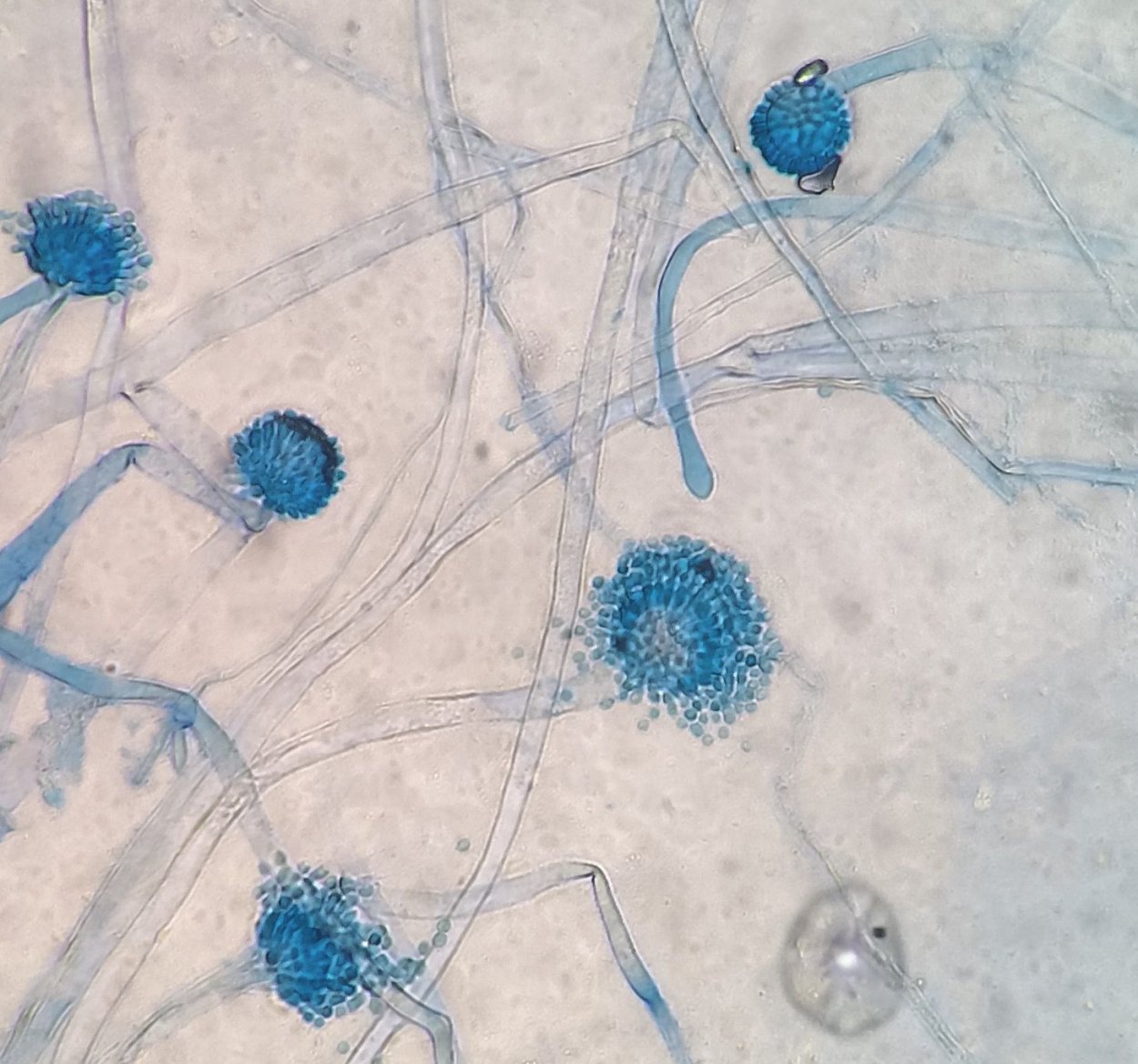 Микроскопические грибы Aspergillus flavus