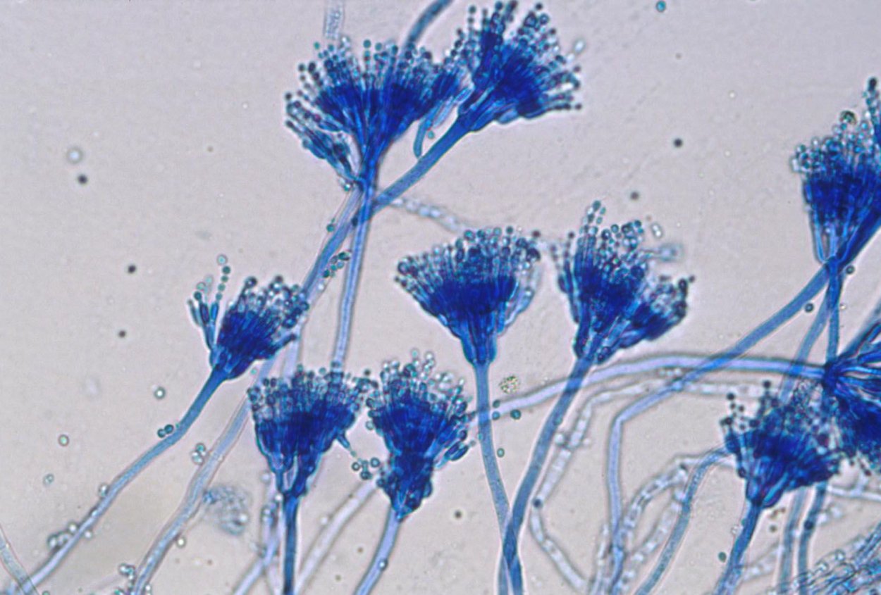 Конидиеносец Aspergillus