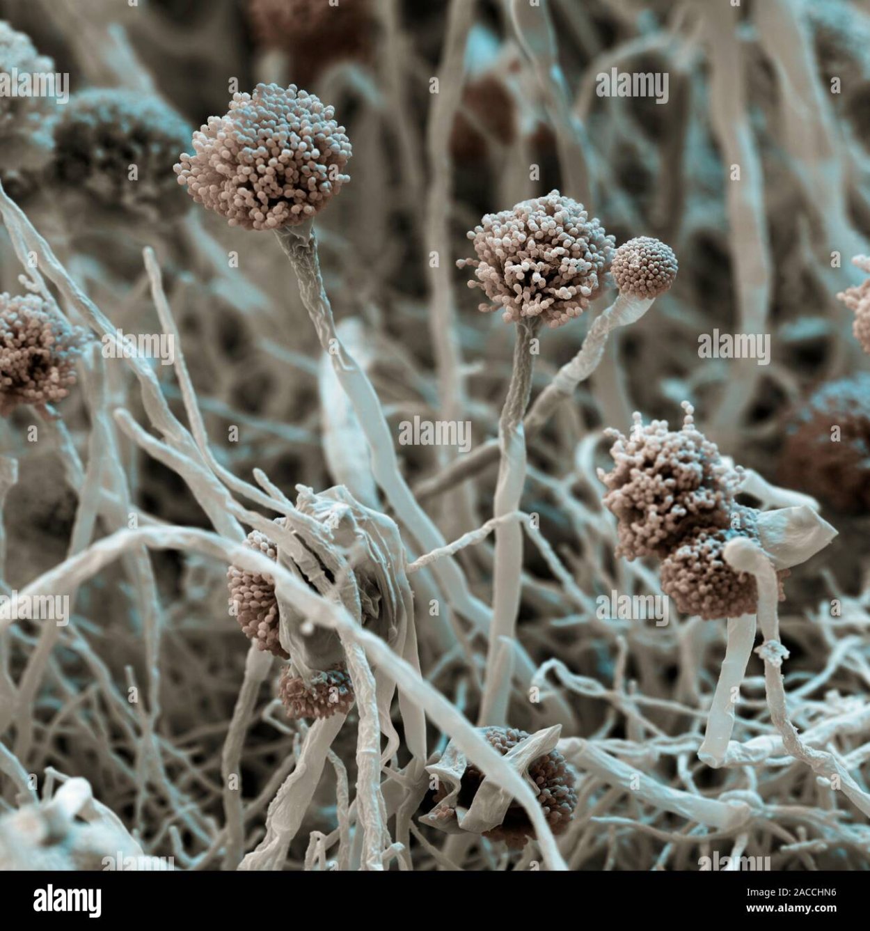 Aspergillus fumigatus микроскоп