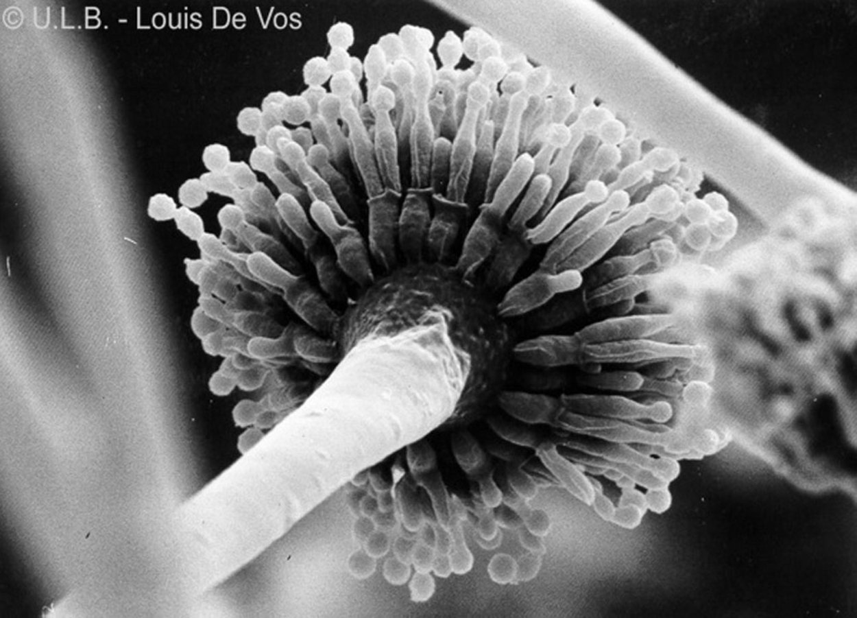 Aspergillus Tubingensis