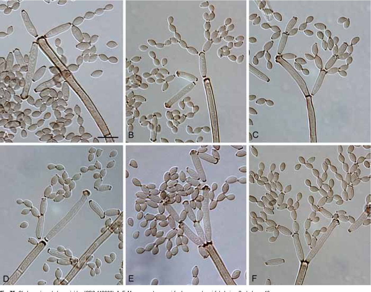 Cladosporium herbarum конидии
