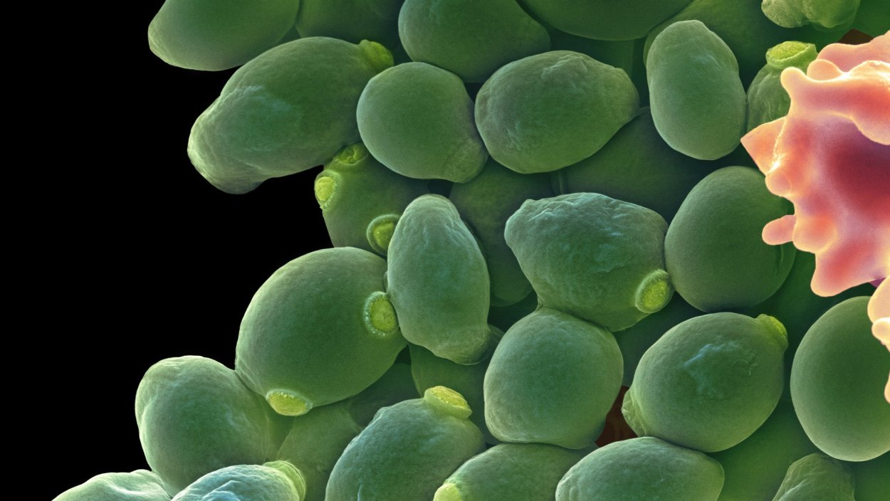 Баланопостит на головке члена фото