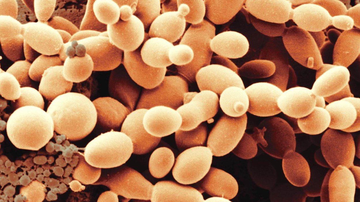 Дрожжи Saccharomyces cerevisiae под микроскопом