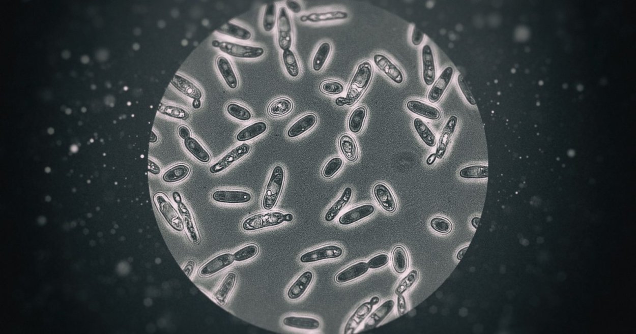 Brettanomyces Bruxellensis