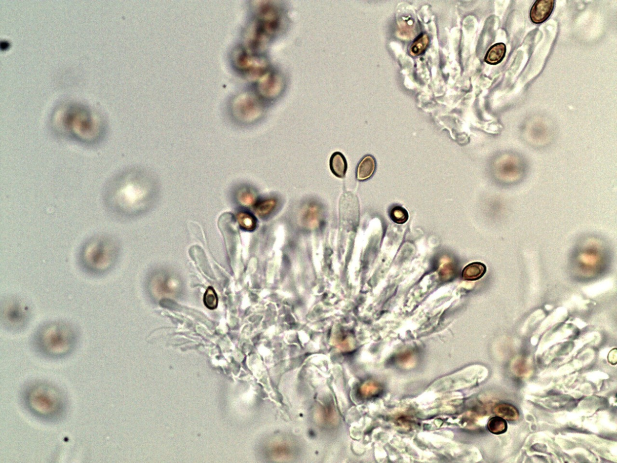 Конидии АНТРАКНОЗА