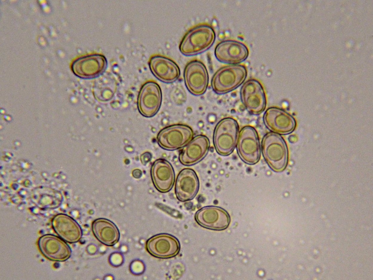 Споры грибов в Кале микроскопия