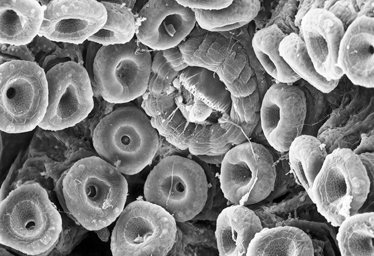 Под электронным микроскопом