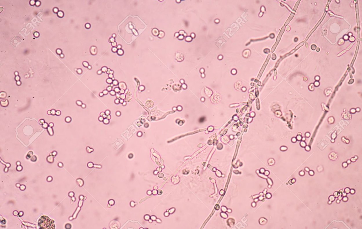 Дрожжеподобные грибы микроскоп
