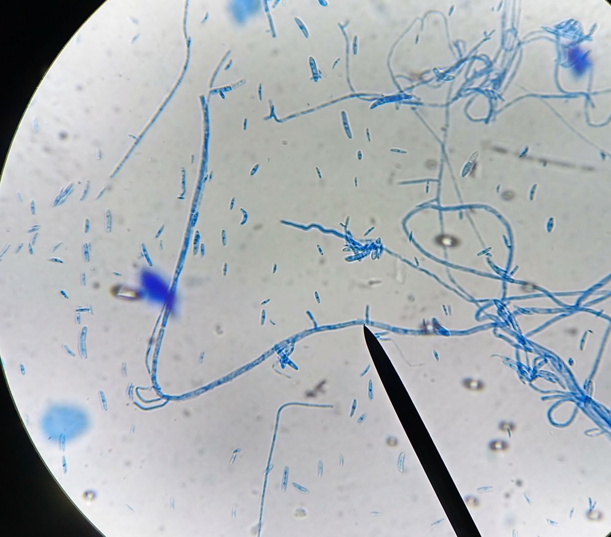 Фузариум оксиспорум