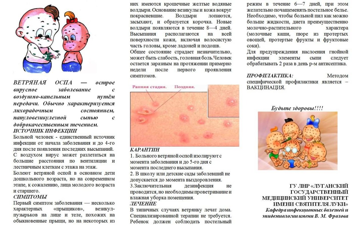 Ветряная оспа у детей сыпь