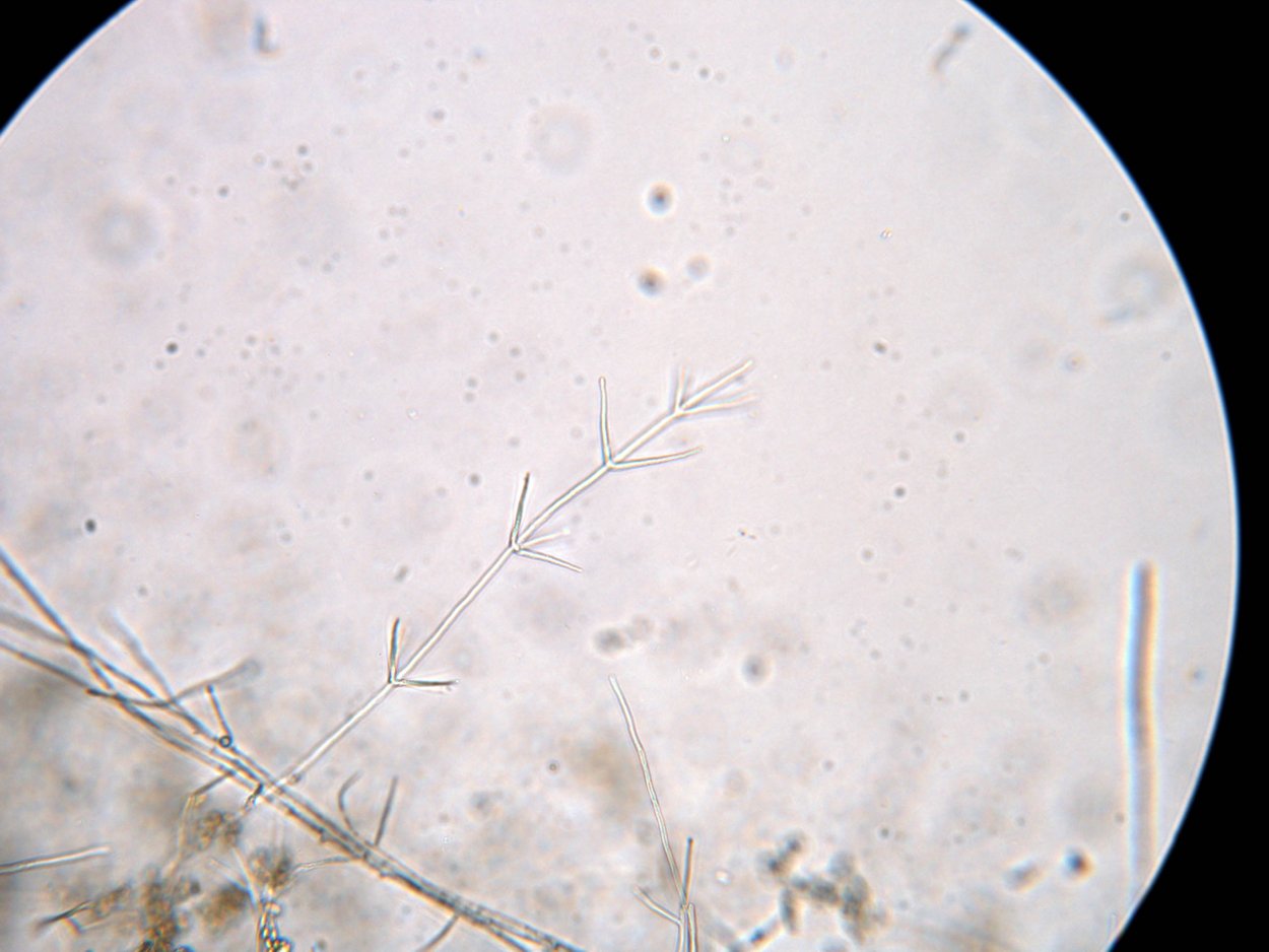 Verticillium dahliae