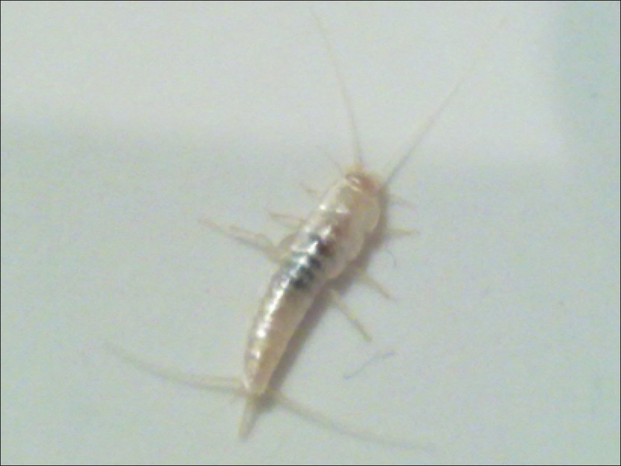 Мокрица насекомое сороконожка