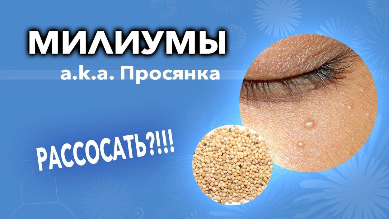 Горец почечуйный всходы