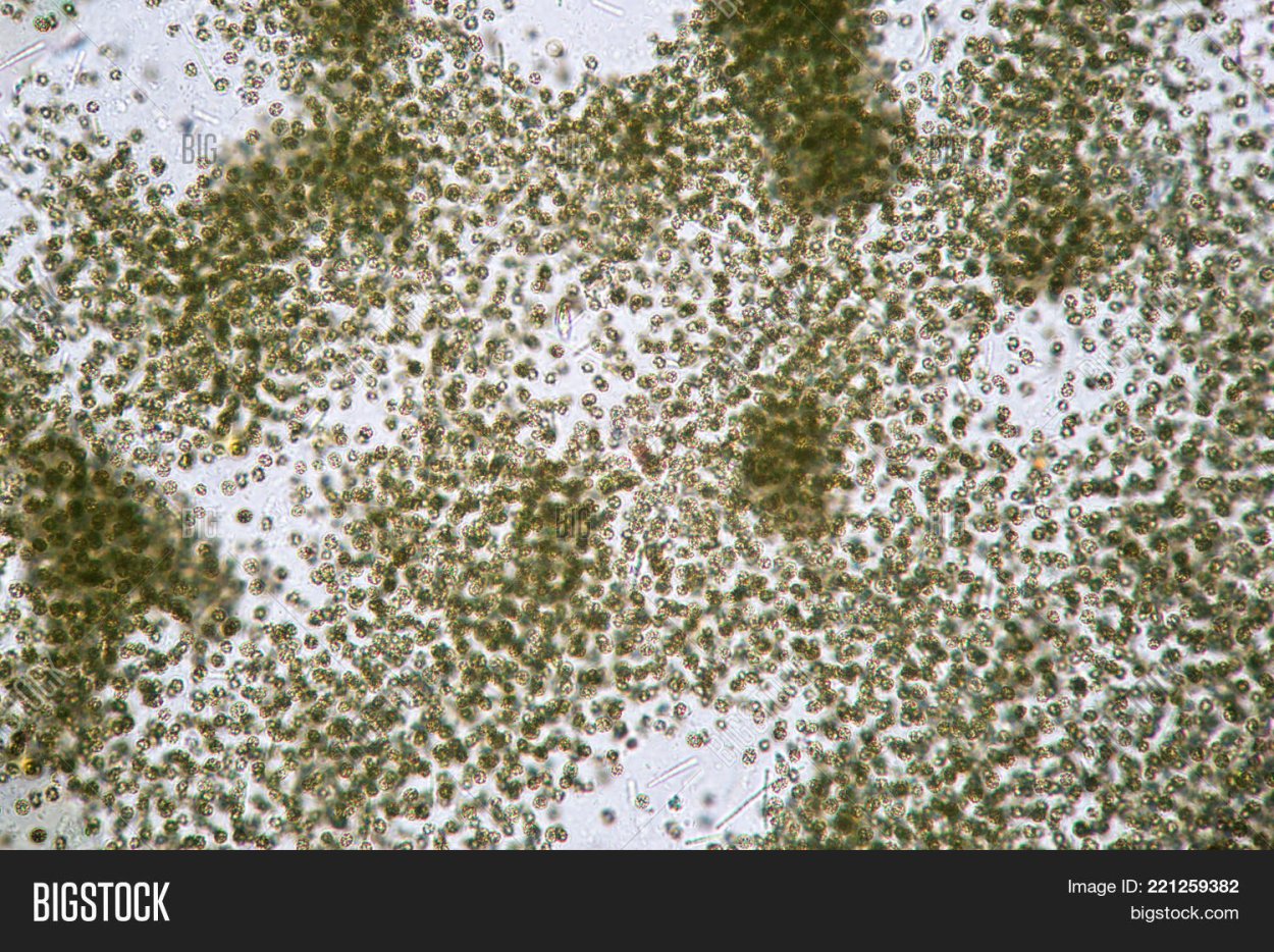 Микроцистис водоросль