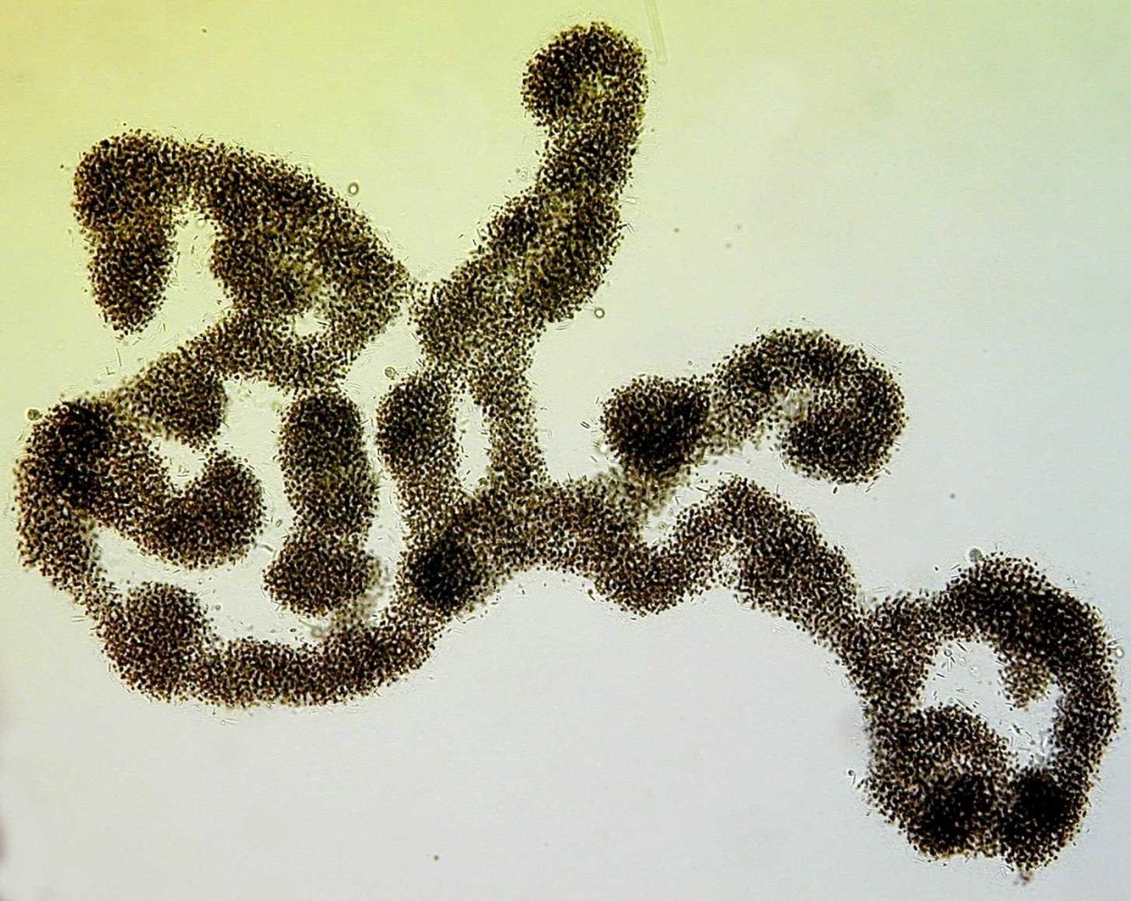 Microcystis aeruginosa