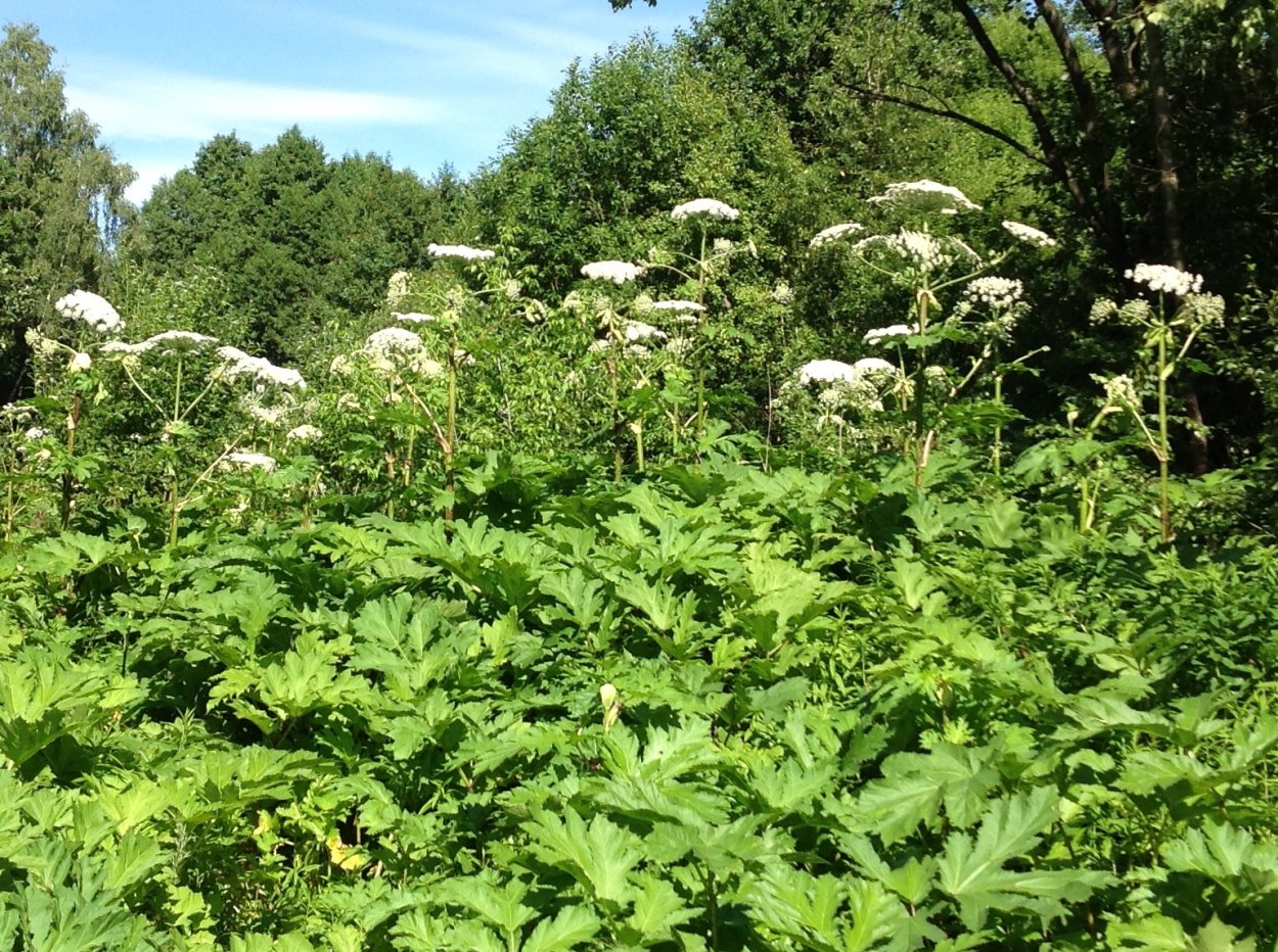 Борщевик Сосновского ожоги