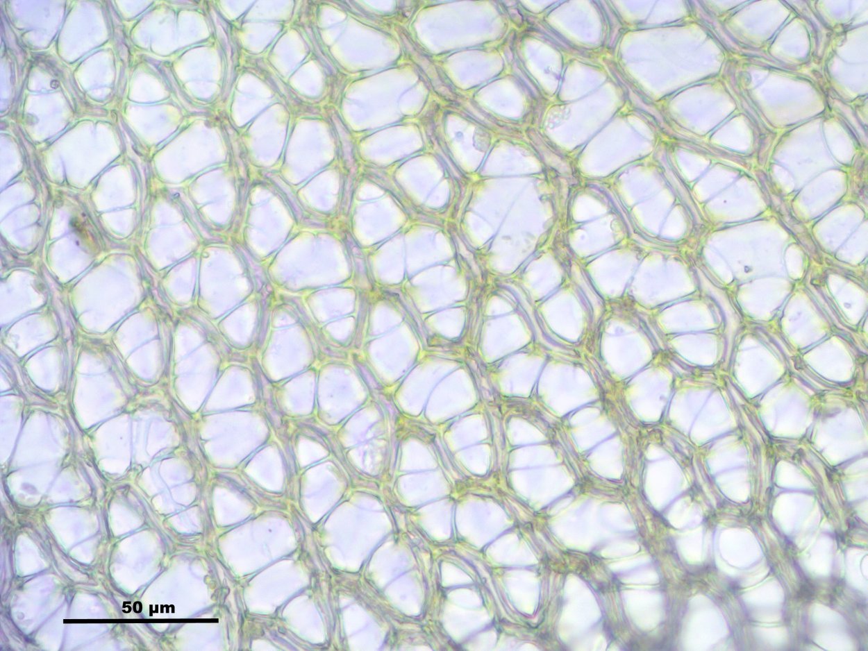 Сфагнум микроскоп