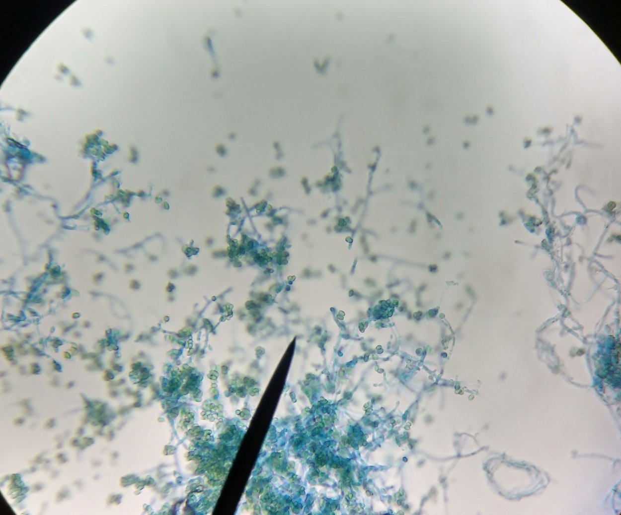 Триходерма viride