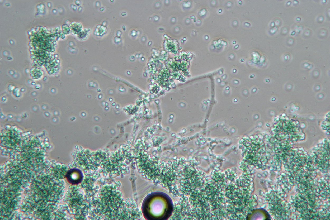 Trichoderma viride в микроскопе