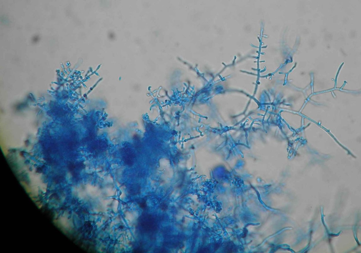 Trichoderma viride под микроскопом