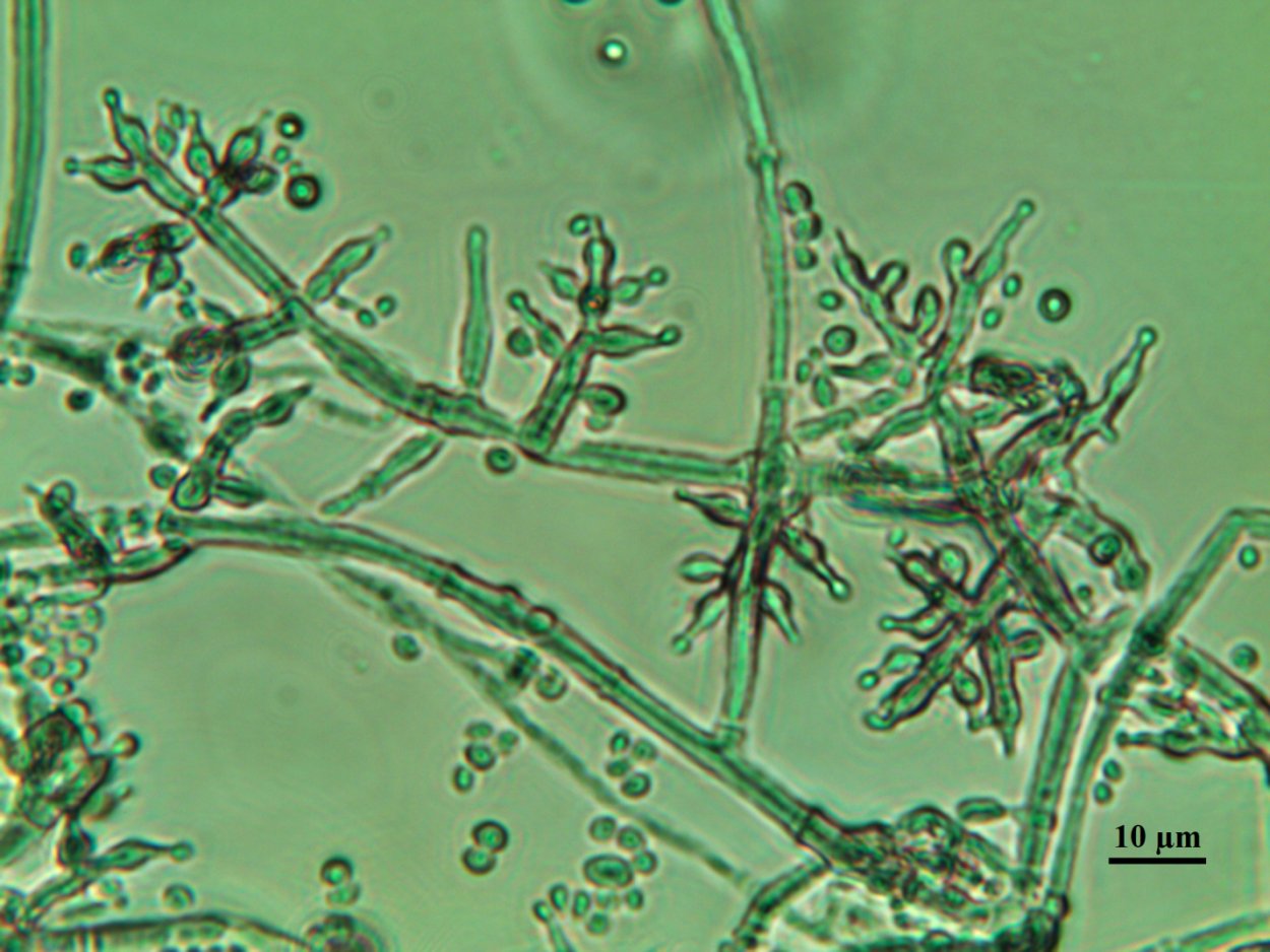 Trichoderma reesei микроскопирование