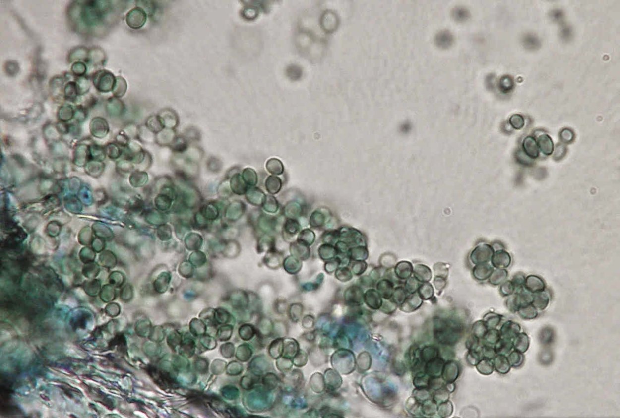 Триходерма viride