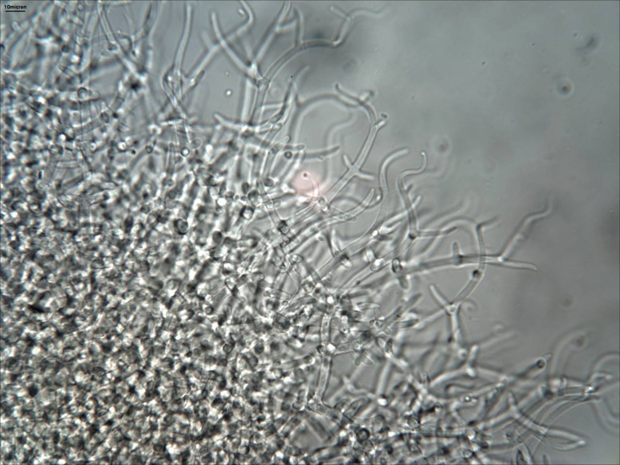 Мицелий триходермы под микроскопом