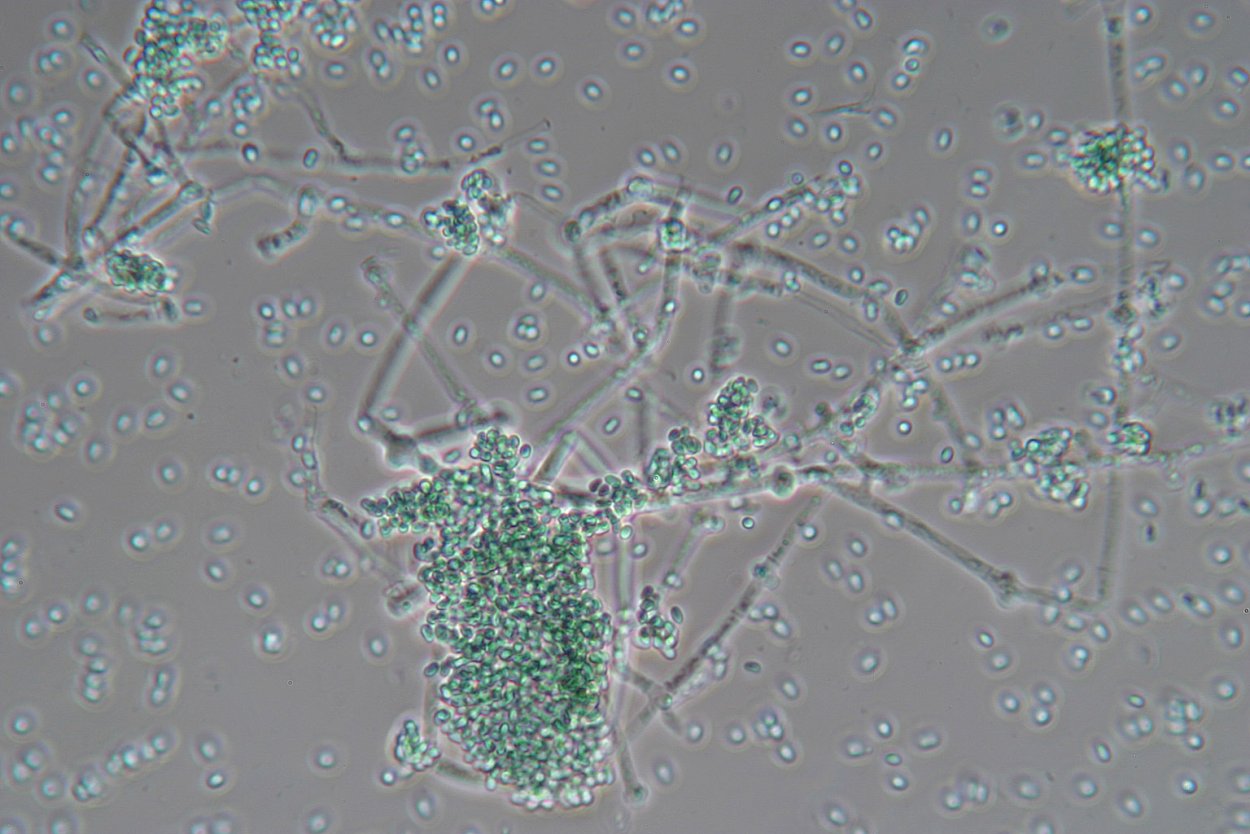 Trichoderma viride в микроскопе