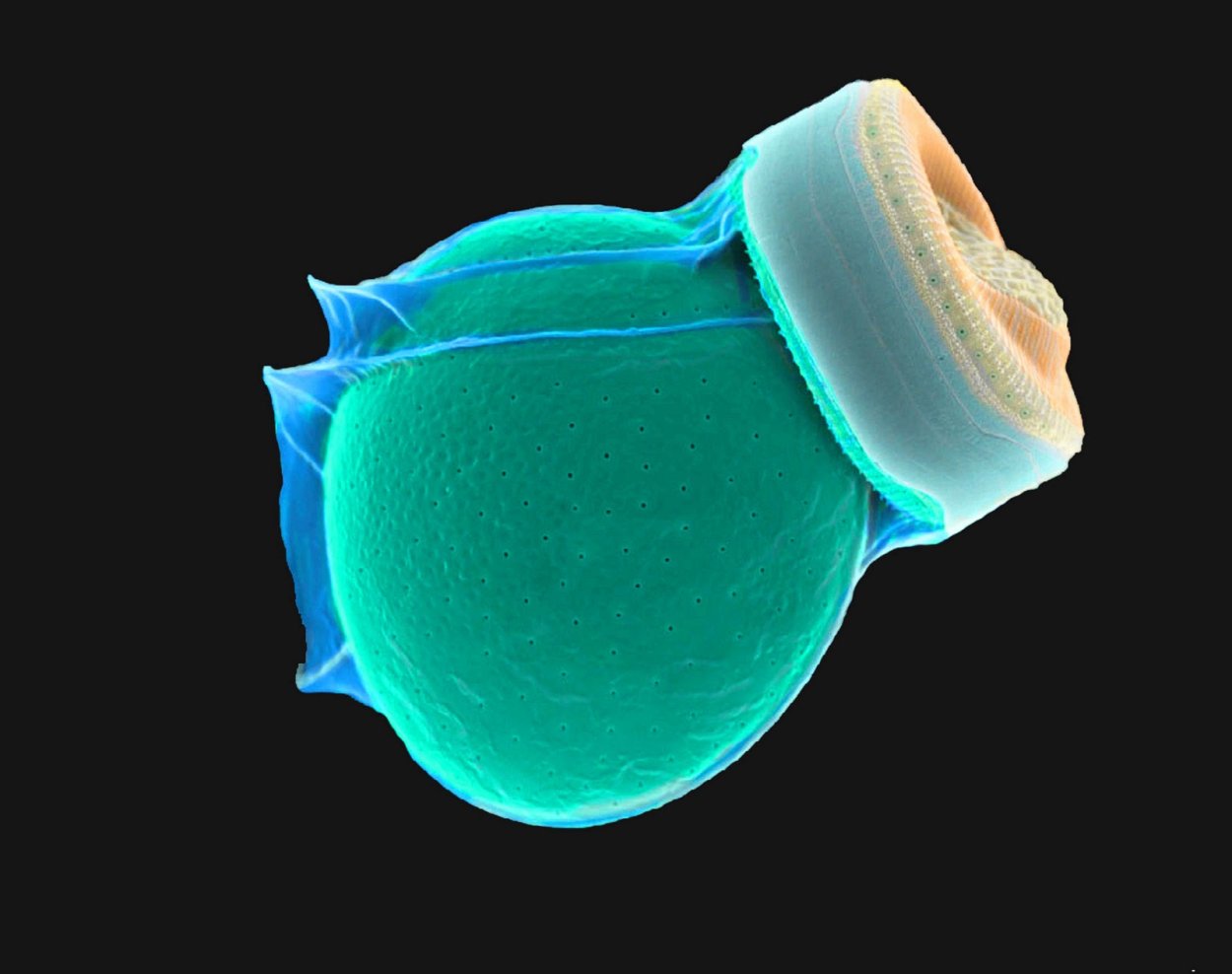 Диатомовые водоросли диатомеи